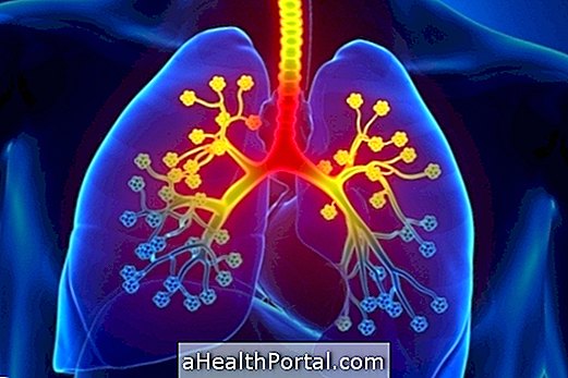 Mikä on hepato-pulmonaarinen oireyhtymä