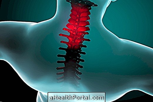 See the care you should take after a spine surgery