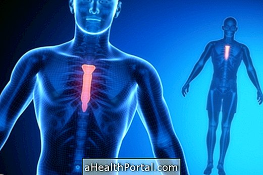 How to identify and treat costochondritis