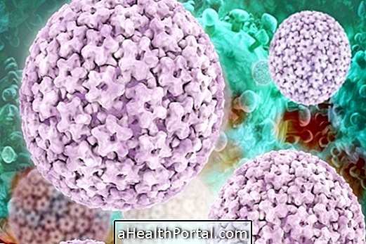 Je li HPV lijek sama?