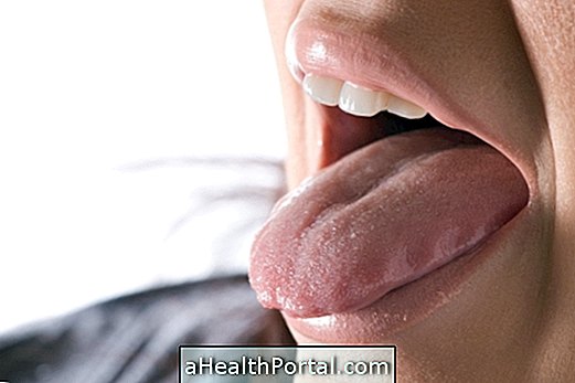 Điều gì có thể là chấm bi trên lưỡi?