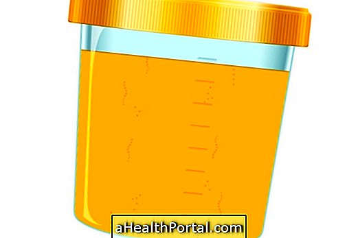 8 Haigused, mis võivad muuta uriini värvi