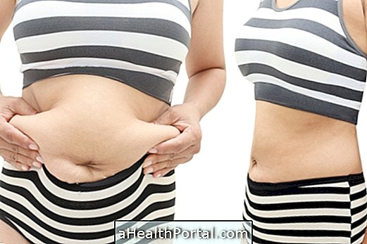 When plastic surgery is indicated after bariatric surgery
