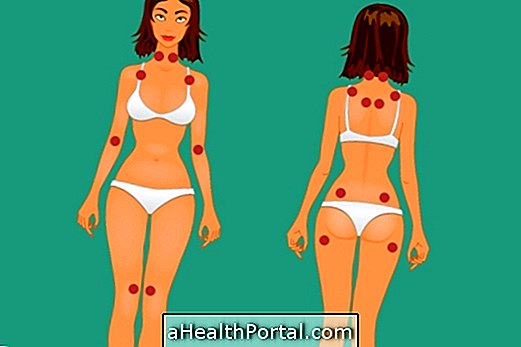 What are the painful spots of Fibromyalgia