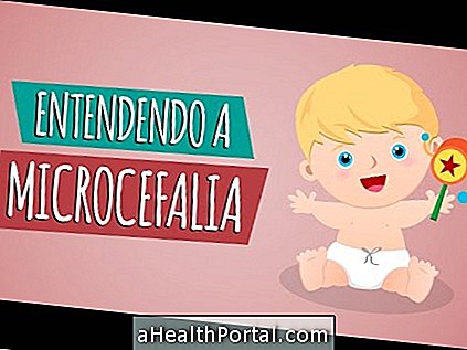 How is the life of the child born with microcephaly?