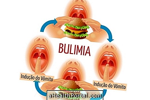 10 Bulimia peamised sümptomid