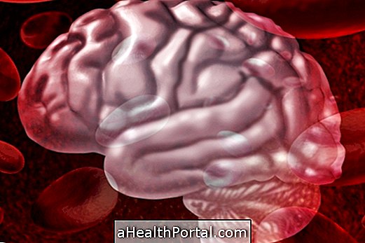 Što uzrokuje moždani udar i kako ga izbjeći