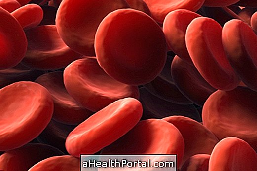 Simptomi večjih vrst anemije