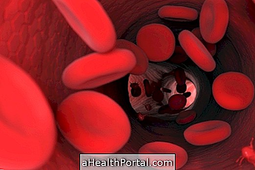 11 Mitos dan Kebenaran Tentang Hemofilia