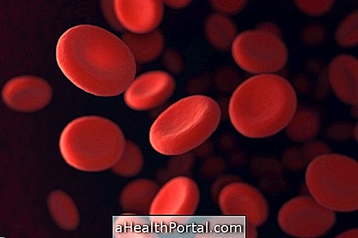 Pernicious anemia: symptoms, diagnosis and treatment