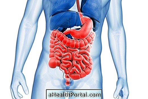 Colitis: What it is, types and main symptoms