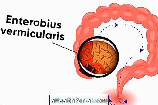 What to do to prevent enterobiosis and how to treat it