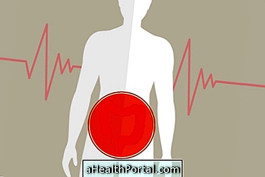 Maladie de Crohn: En savoir plus sur ce mal (Guide complet)