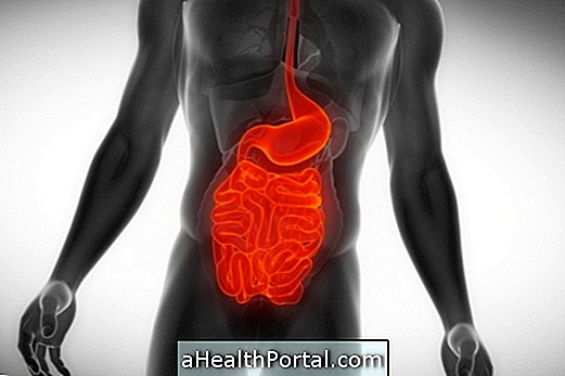 gangguan gastrointestinal - Cara Meredakan Gejala Sindrom Dumping