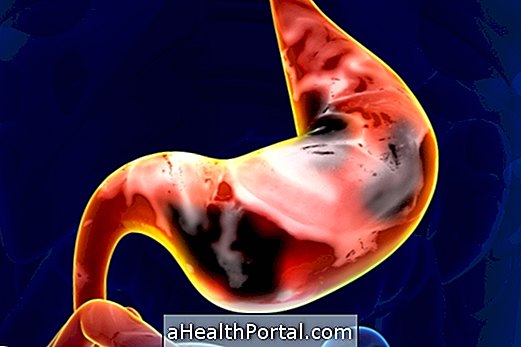Hvad kan forårsage høj eller lav gastrointestinal blødning