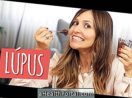 Bệnh Lupus là gì?