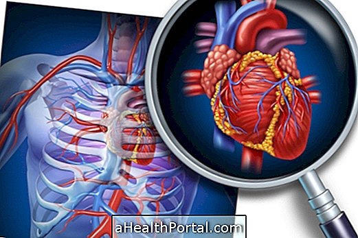 Hvad er hjerte-kar-sygdomme og hovedtyper