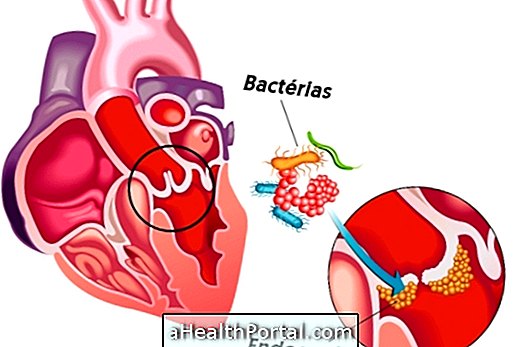 Treatment for Bacterial Endocarditis
