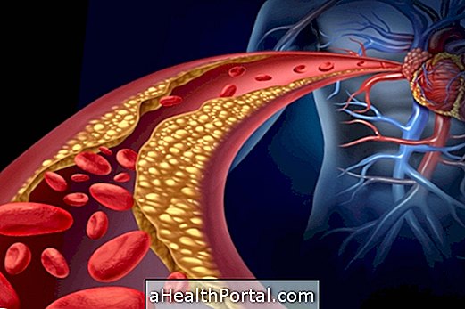 Hvad er angina og hvordan man behandler det