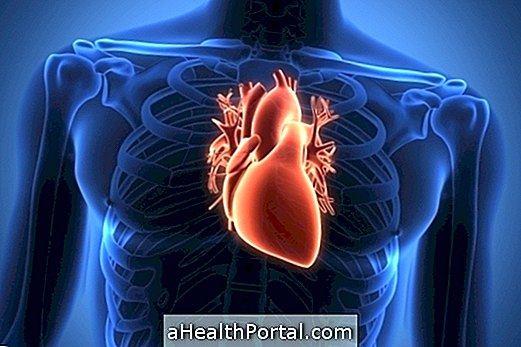 Chronic Pericarditis: What It Is, Symptoms and Causes