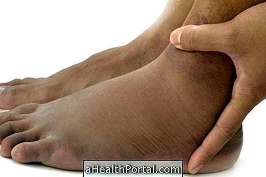 How is the treatment for poor circulation