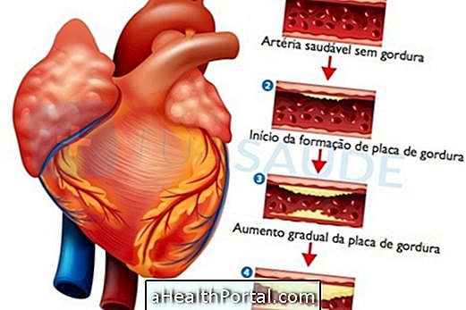 Traitement pour la calcification aortique