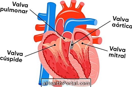Apakah penyakit jantung kongenital dan jenis utama
