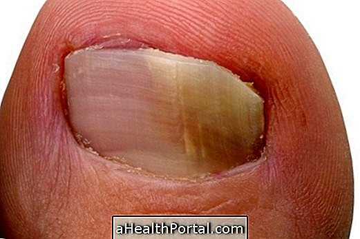 7 tipuri de cicatrizare a pielii și cum se tratează