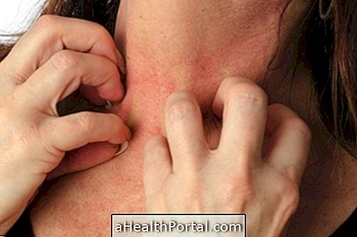 6 førende årsager til kløende hud og hvordan man behandler