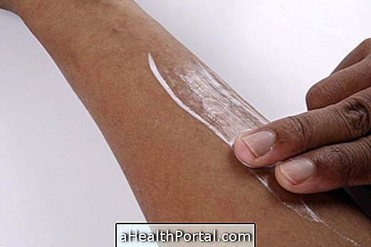 Hvordan man behandler mycosis af hud og negle