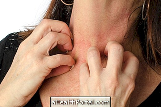 Apakah gejala yang menunjukkan dermatitis atopik
