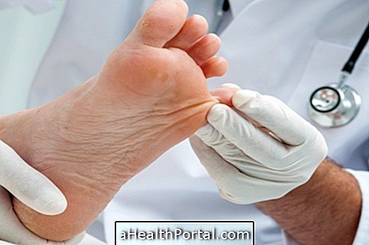 Treatment to cure Chronic Fatigue (Athlete's Foot)