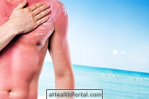 Hvordan man identificerer og behandler de 7 mest almindelige hudsygdomme om sommeren