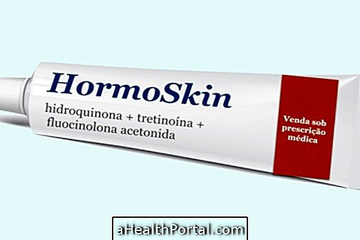 Comment utiliser la crème blanchissante Hormoskin pour le mélasma