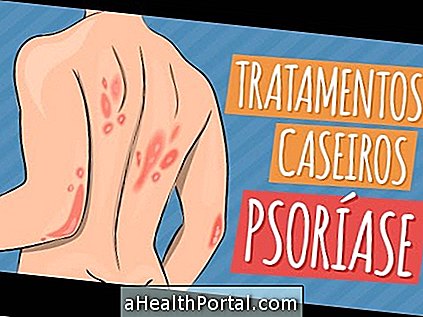 Mittel gegen Psoriasis