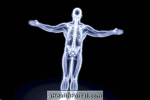 Learn About the Symptoms, Treatment and Cure for Bone Cancer