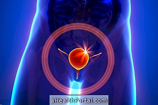 How to Identify and Treat Bladder Cancer