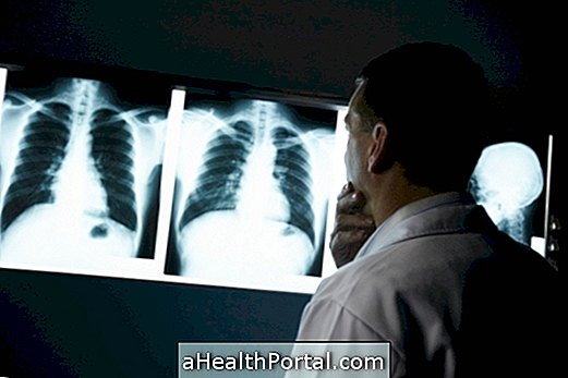 How is the treatment for lung cancer done?