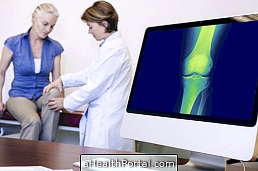 Fysioterapi til bekæmpelse af osteoporose og styrke knogler