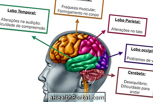 Forstå hjerne tumoren og de vigtigste symptomer