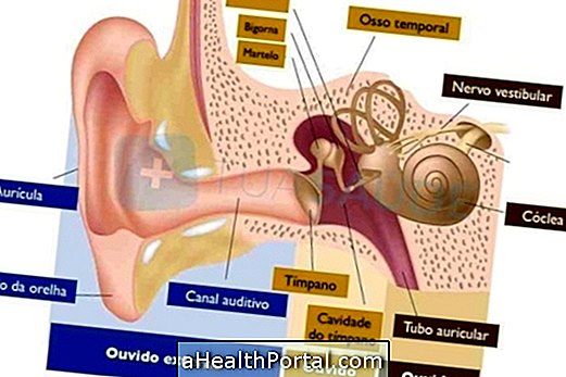 Conductive hearing loss