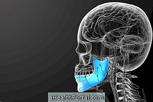 How To Identify Jaw Cancer