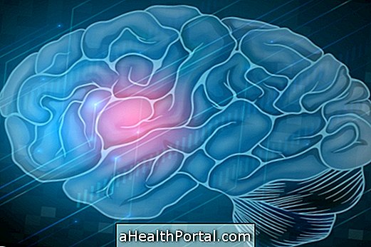 Kako prepoznati i liječiti moždani udar