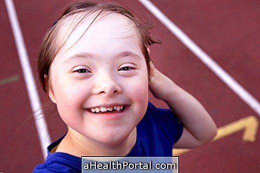 Know What Down Syndrome Is
