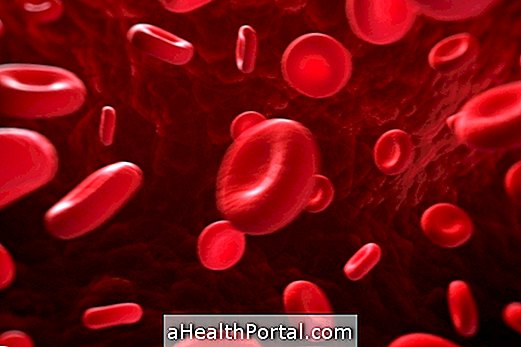 Wat hemochromatose is en hoe de symptomen te identificeren