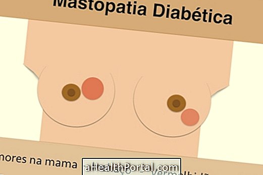 Lær hvordan man behandler diabetisk mastopati