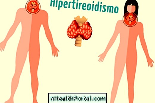 Ketahui tentang Rawatan Hyperthyroidism
