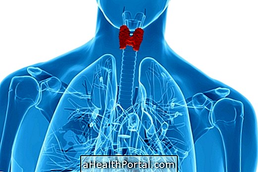 Penyakit utama berkaitan dengan tiroid