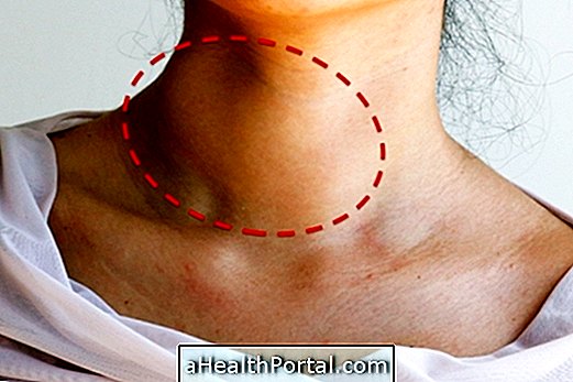 Вузол в щитовидній залозі: що це означає, симптоми та типи