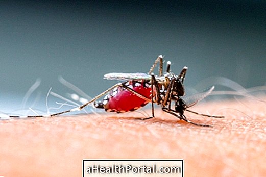 Erfahren Sie, wie Sie effektiv Dengue verhindern können